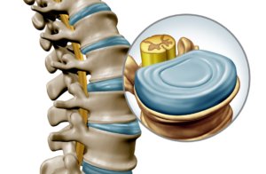 vertebral disc components